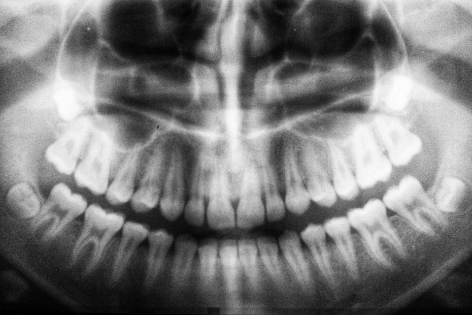 dental
